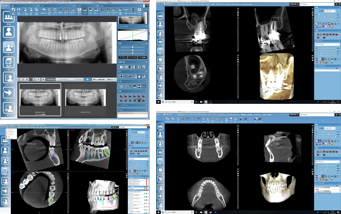 歯科用CTの特徴